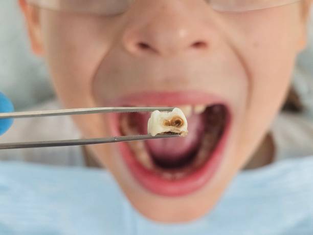 Best Emergency Gum Treatment in Idylwood, VA
